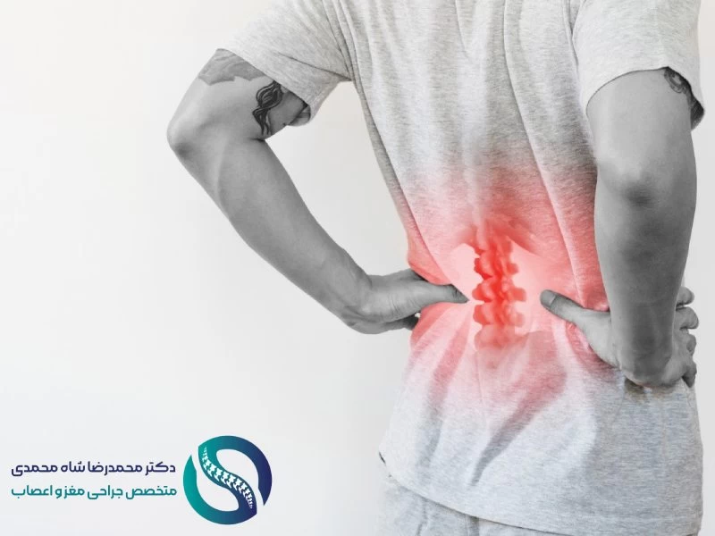 چه کسانی به جراحی میکروسکوپی دیسک کمر نیاز دارند؟