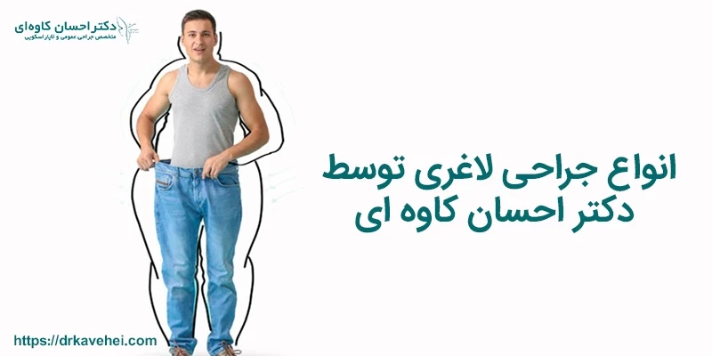 انواع جراحی لاغری توسط دکتر احسان کاوه ای