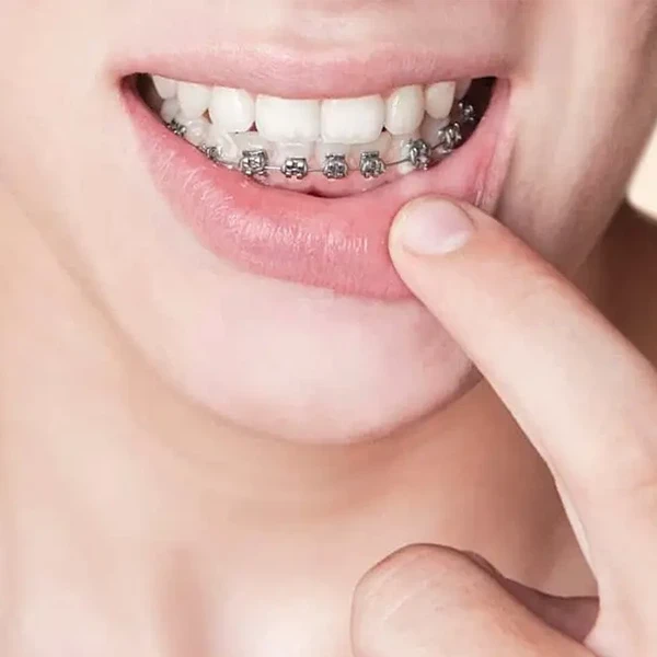 ۵ علت درد لثه و فک پایین که باید جدی بگیرید!