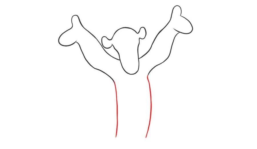 نقاشی بچگانه