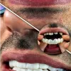 قیمت لمینت دندان دو فک اصلی برای خرابی 8 دندان...