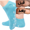 قیمت جوراب سیلیکونی ترک پا