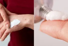 ژل سوختگی رادیوتراپی / تسکین دهنده عوارض درمانی