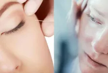 پپتاید جایگزینی طبیعی برای بوتاکس