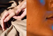 مراقبت های ضروری بعد از برنزه کردن پوست