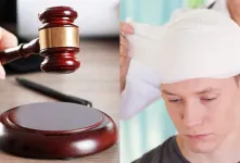 دیه شکستگی سر و جمجمه چقدر است ؟ میزان و نحوه محاسبه
