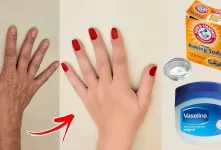 روش طبیعی برای سفید کردن نواحی تیره بدن / سفید ،بدون چروک، صاف و جوان تر