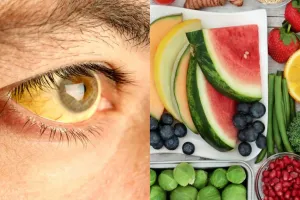 رژیم غذایی بیلی روبین / راهکارهای تغذیه ای برای سلامت کبد