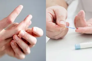 بررسی تاثیر دیابت بر مفاصل و استخوان ها