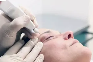 تفاوت پلکسر و بلفاروپلاستی / کدام روش برای شما مناسب تر است؟