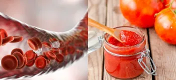 چگونه رب گوجه‌ فرنگی به بهبود کم‌ خونی کمک می‌ کند؟