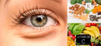 کمبود این ویتامین باعث پف زیر چشم می شود !