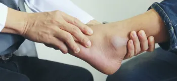 شکستگی قوزک پا چه علائم و درمانی دارد؟