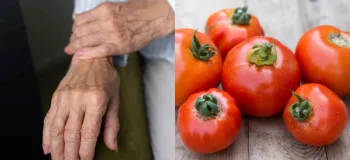 تاثیر گوجه فرنگی بر آرتروز و فواید آن برای سلامت مفاصل