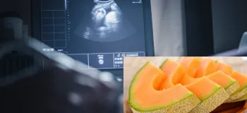 خواص ملون برای جنین و تاثیرات مثبت آن بر بارداری