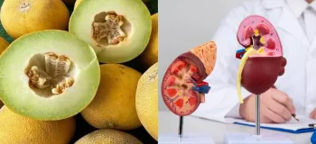 خواص شگفت انگیز خربزه برای کلیه