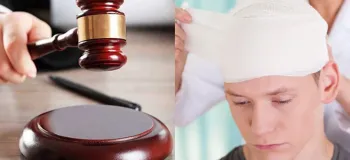 دیه شکستگی سر و جمجمه چقدر است ؟ میزان و نحوه محاسبه