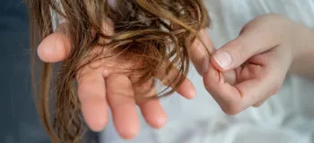علت و درمان کش آمدن مو / راه های مراقبت و بهبود