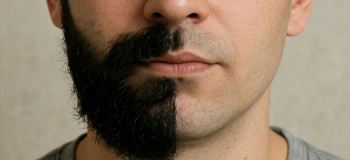 دیگه صورتت رو اصلاح نکن / از بین بردن موهای زائد بدون درد و سوزش