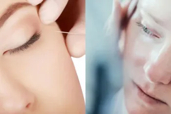 پپتاید جایگزینی طبیعی برای بوتاکس