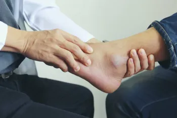 شکستگی قوزک پا چه علائم و درمانی دارد؟