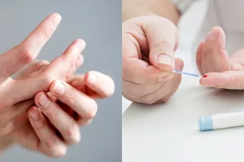 بررسی تاثیر دیابت بر مفاصل و استخوان ها