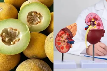 خواص شگفت انگیز خربزه برای کلیه