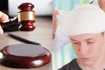 دیه شکستگی سر و جمجمه چقدر است ؟ میزان و نحوه محاسبه