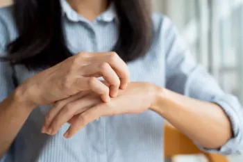 روش های رفع تندی فلفل از پوست دست