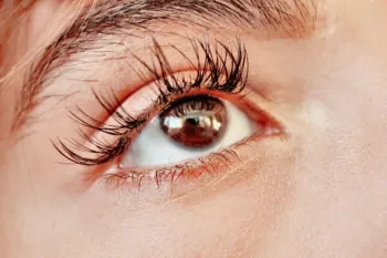 چرا چسب مژه چشم را می سوزاند؟ علل و راه های پیشگیری