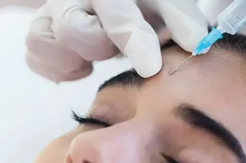 آیا تزریق بوتاکس باعث لیفت ابرو و پیشانی می شود؟!