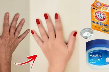 روش طبیعی برای سفید کردن نواحی تیره بدن / سفید ،بدون چروک، صاف و جوان تر