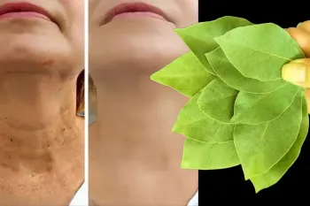 نحوه استفاده از برگ بو برای کلاژن سازی ۱۰۰ درصد چین و چروک