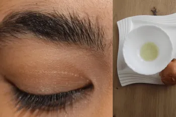 رشد سریع ابروها و مژه های ریخته شده به صورت گیاهی و خانگی در مدت ۳ روز
