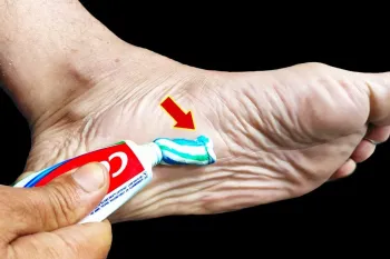 معجزه خمیردندان برای کف پاها را ببینید