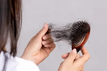 حل مشکل ریزش مو | چیکار کنم ریزش مو قطع بشه ؟