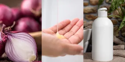 معجزه ی شامپو پیاز