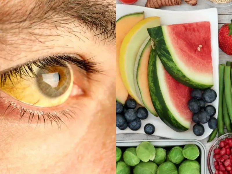 رژیم غذایی بیلی روبین / راهکارهای تغذیه ای برای سلامت کبد