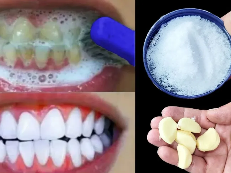 سفید کردن دندان در خانه فقط در 2 دقیقه! بدون دکتر، بدون هزینه!