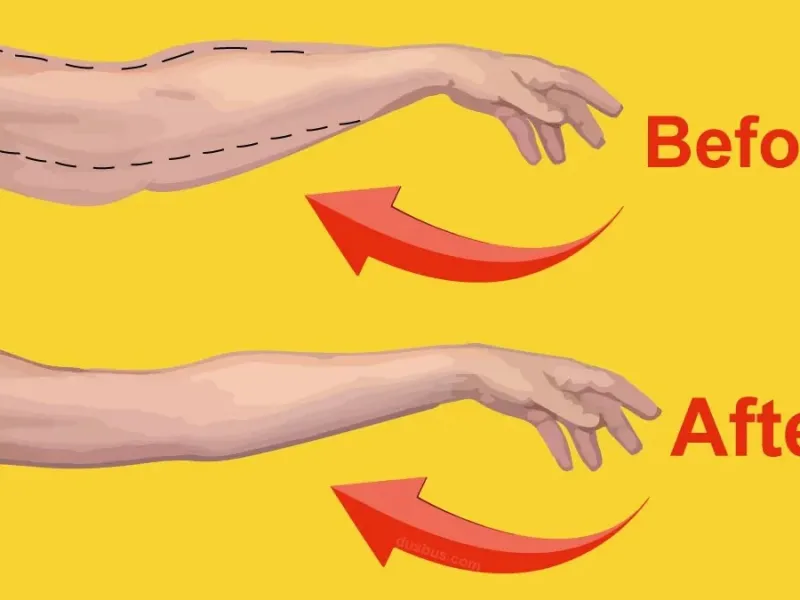 درمان شلی بازو در خانه بدون نیاز به هیچ وسیله خاصی